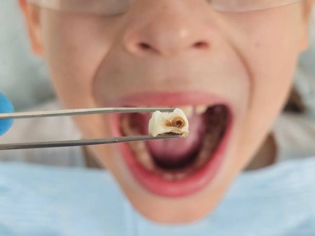 Best Pediatric Emergency Dentist in Bosque Farms, NM